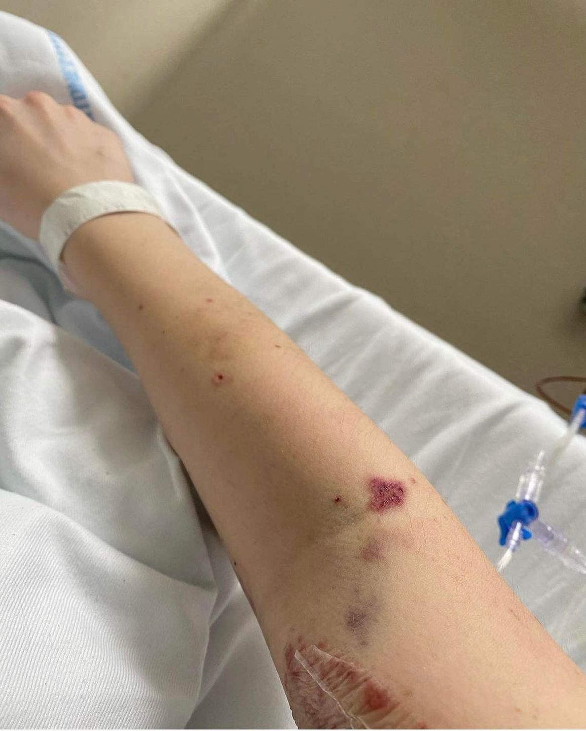 Wiktoria Cwynar zapadła na tajemniczą chorobą