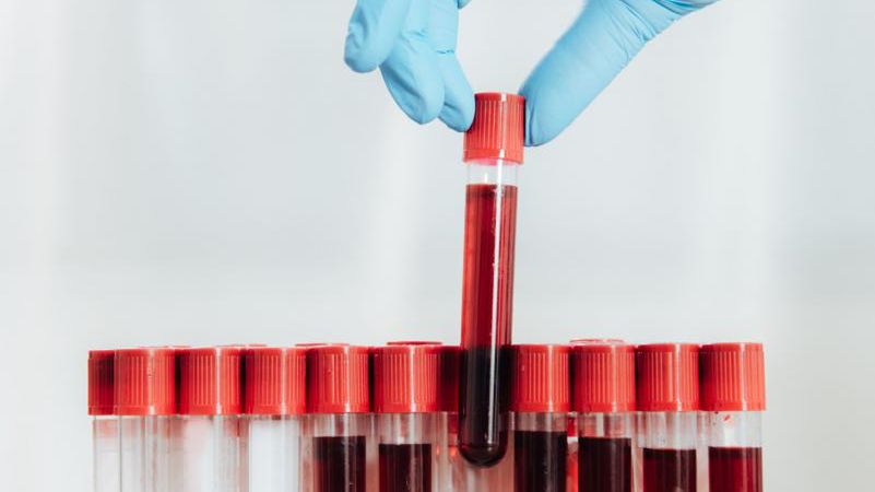 Odczyn Coombsa to procedura medyczna, która pozwala we krwi pacjenta wykryć przeciwciała skierowane przeciw antygenom erytrocytów. 