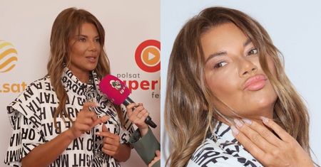 Edyta Górniak zrobiła sobie botoks? "Człowiek zaczyna wyglądać jak WATA" (WIDEO)