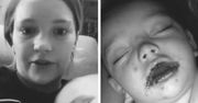 Chłopiec obudził się z czerwoną wysypką na ustach. "Uważajcie!" - apeluje jego mama