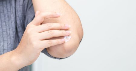 Nieestetyczne łokcie – przyczyny, objawy i domowe sposoby