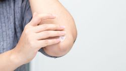 Nieestetyczne łokcie - przyczyny, objawy i domowe sposoby