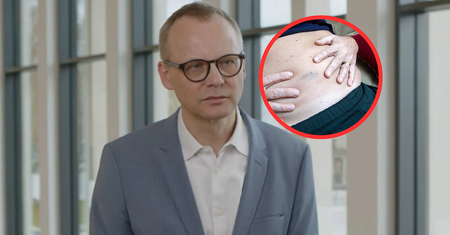 Stłuszczenie wątroby dotyka już 6 mln Polaków. "Diagnozowana jest mniej niż połowa osób"