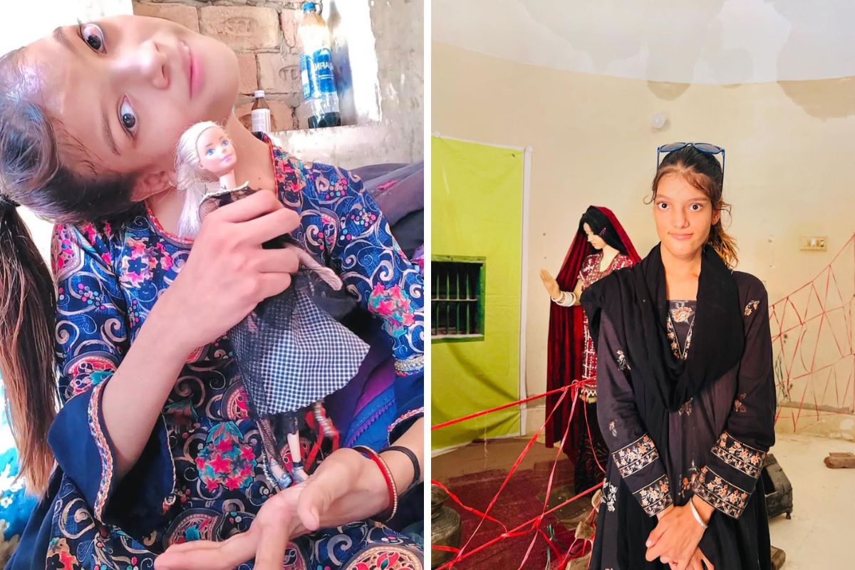 Dziewczynka przeszła skomplikowaną operację w wieku 14 lat