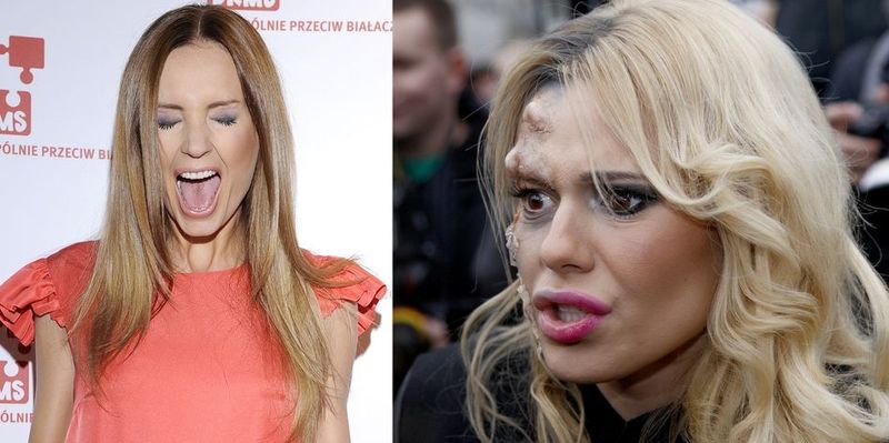 Doda pobiła Szulim?! Doszło do rękoczynów!