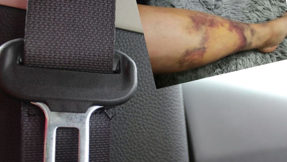 Tak kończy się niezapinanie pasów bezpieczeństwa i brak fotelika dla dziecka. Specjalista od fotelików apeluje do rodziców