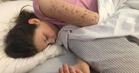 Matka pokazała szokujące zdjęcia. Mówi, że jej córka miała koronawirusa