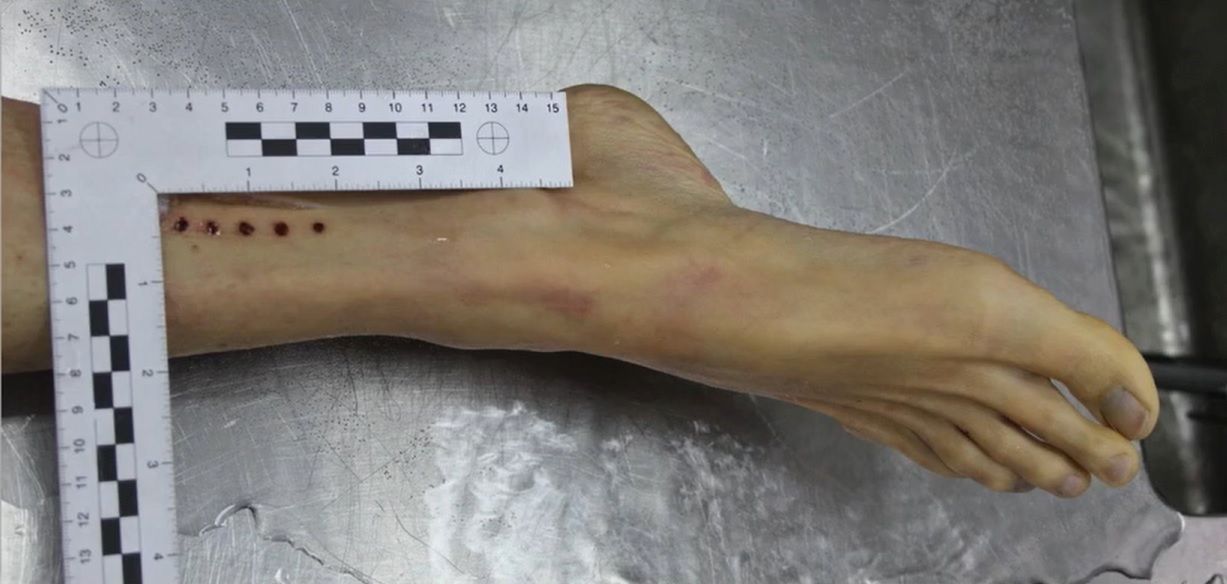 &quot;Jedyne &quot;obrażenia&quot;, które ujawniono na ciele zmarłej kobiety&quot;