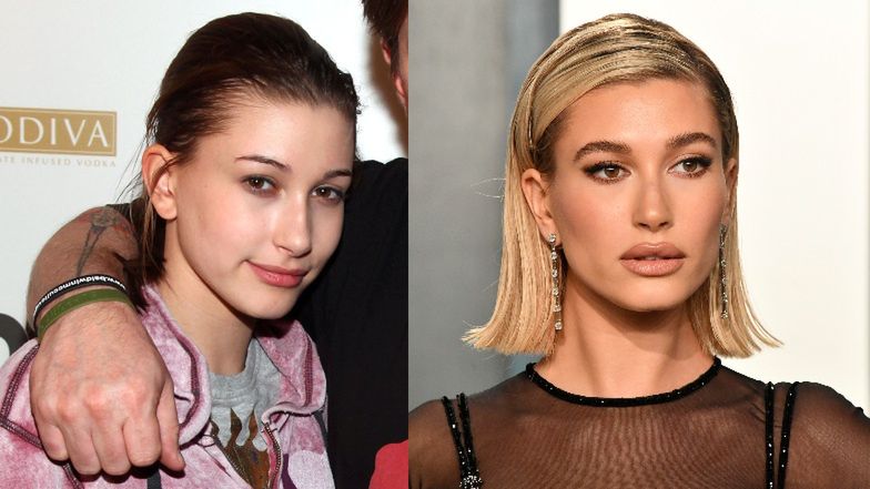 Hailey Bieber twierdzi, że nie miała operacji plastycznych