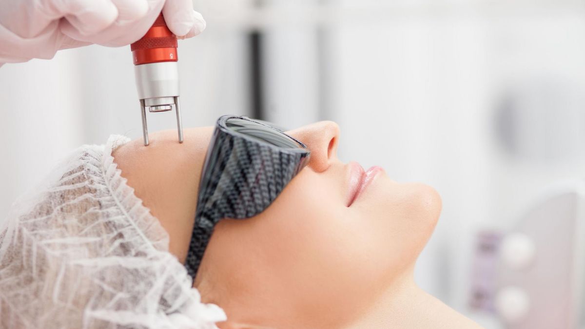 Kuracja laserem frakcyjnym może być dość kosztowna