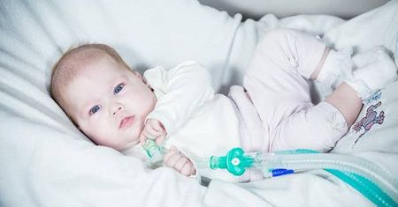 Prośba o pomoc dla 10 miesięcznej Bianki z Lubartowa. Tylko 300 takich osób na świecie