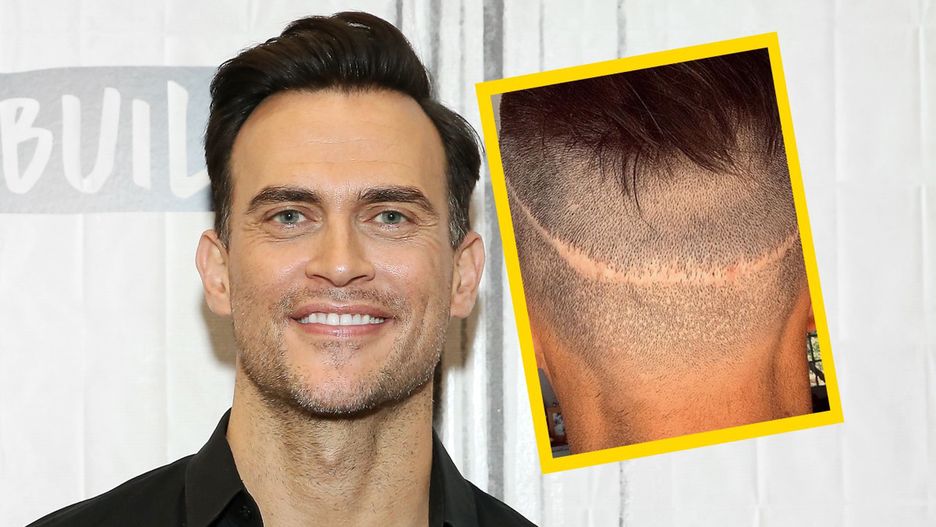 Cheyenne Jackson wstydził się powiedzieć, że walczy z łysieniem
