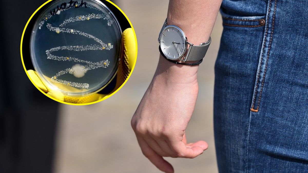 Na biżuterii roi się od bakterii 