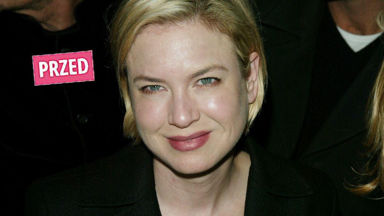 Jak obecnie wygląda Renée Zellweger? (fot. Getty Images)