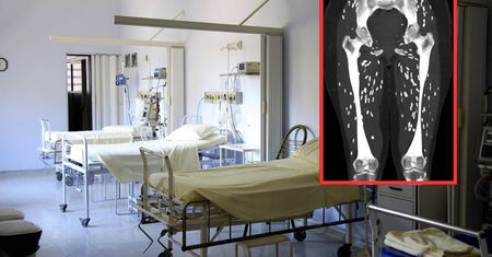 Pokazał zdjęcie rentgenowskie zakażonego pacjenta. Widok budzi niepokój