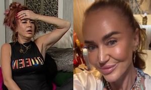 Agnieszka Kotońska opowiada o operacjach plastycznych i zapewnia: "Jak zacznie mi coś przeszkadzać, PÓJDĘ NA STÓŁ"