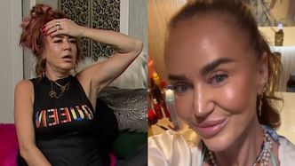 Agnieszka Kotońska opowiada o operacjach plastycznych i zapewnia: "Jak zacznie mi coś przeszkadzać, PÓJDĘ NA STÓŁ"