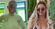 Influencerka, która płonęła żywcem na imprezie, pokazała się w BIKINI. "Życie jest za krótkie na chowanie się" (FOTO)