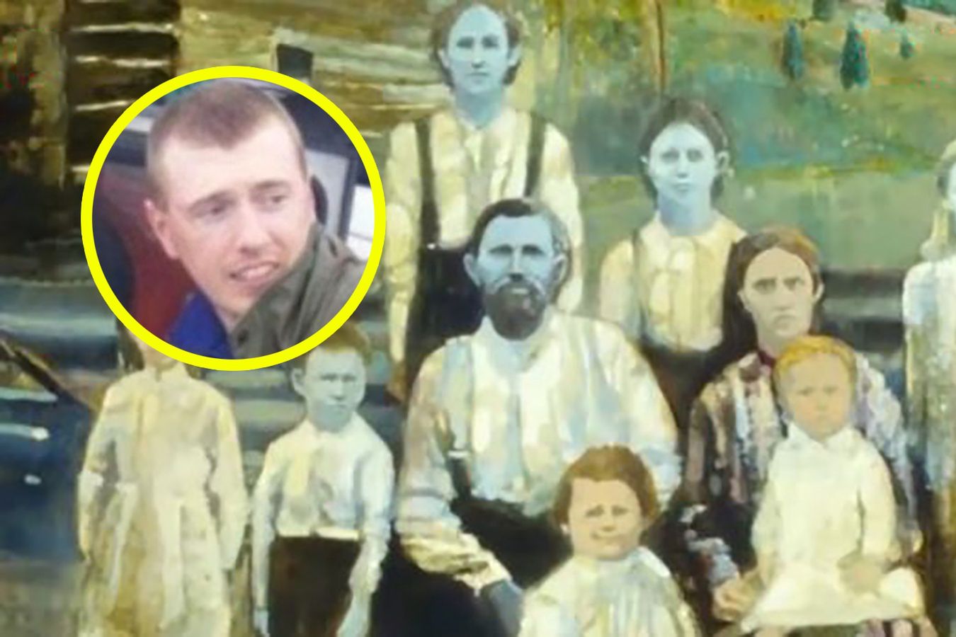 47-letni Ben Stacy urodził się w rodzinie z mutacją genu recesywnego