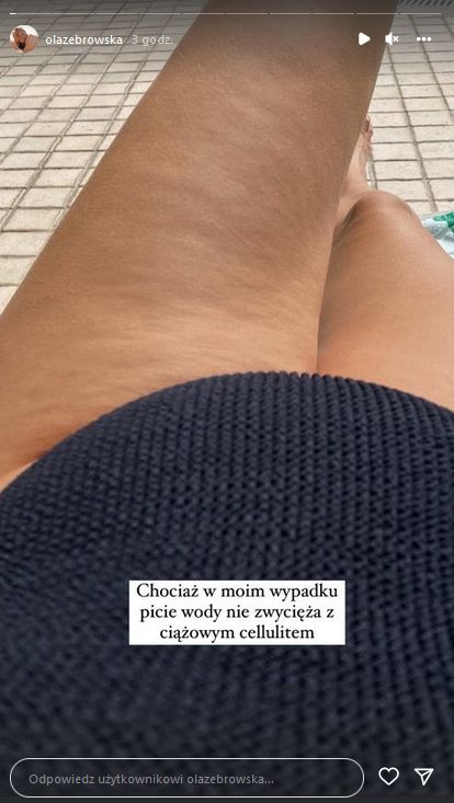 Aleksandra Żebrowska prezentuje cellulit