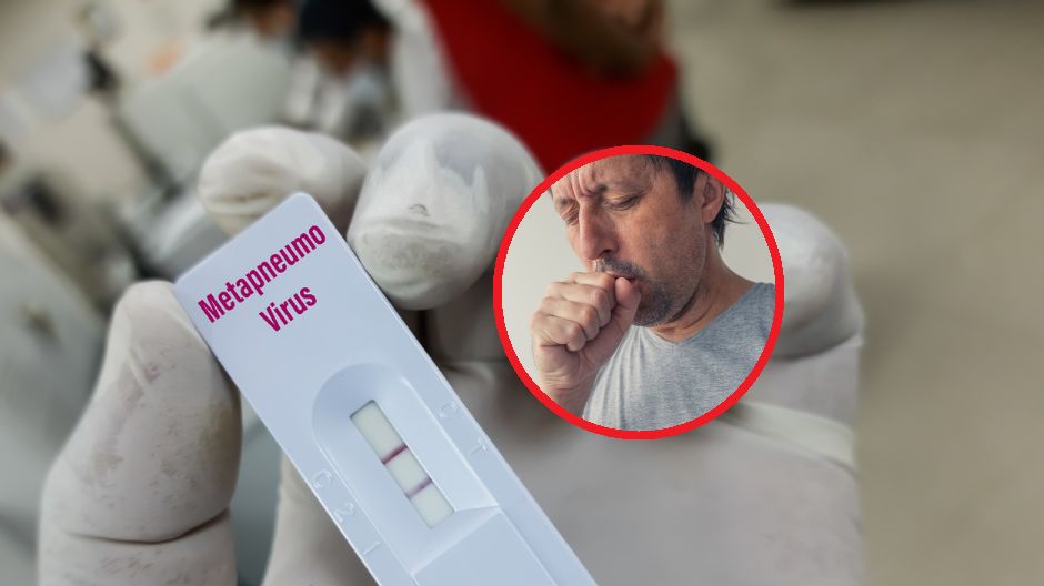 Ludzki metapneumowirus jest tak niebezpieczny jak grypa i RSV