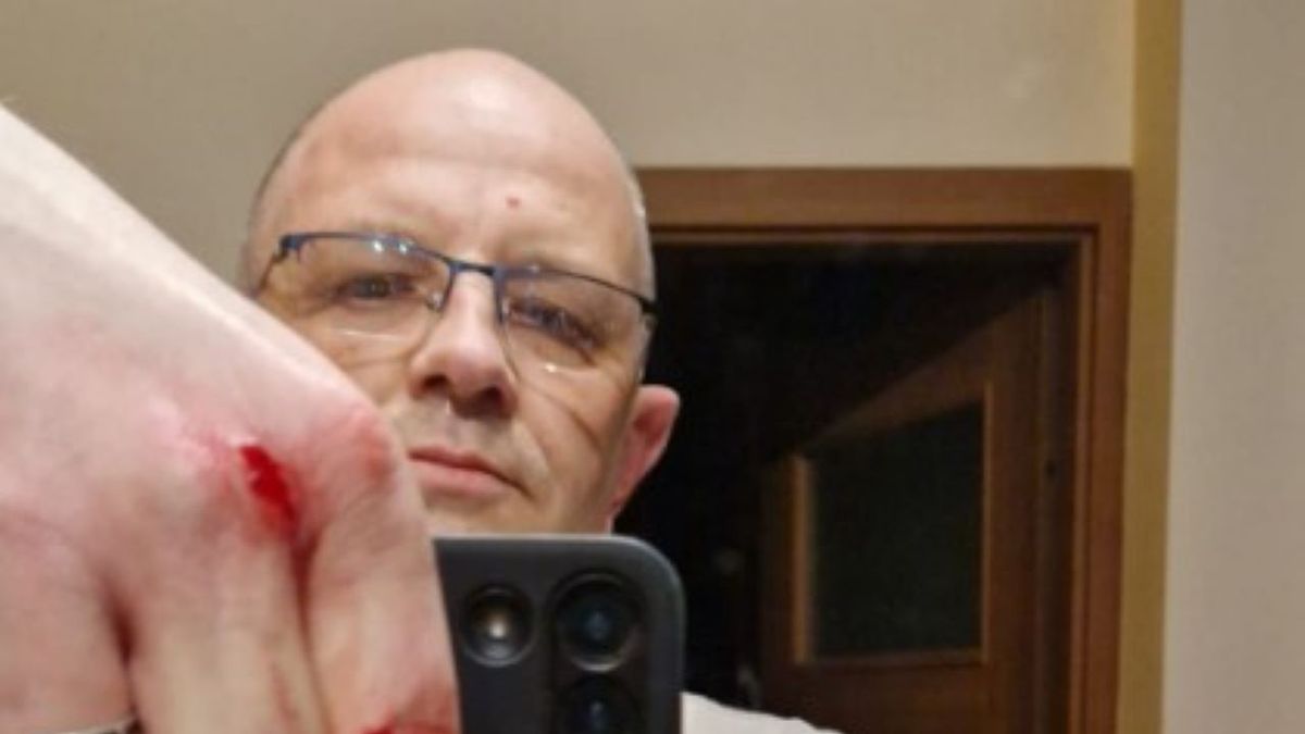 Radny PiS został zaatakowany przez dzika 