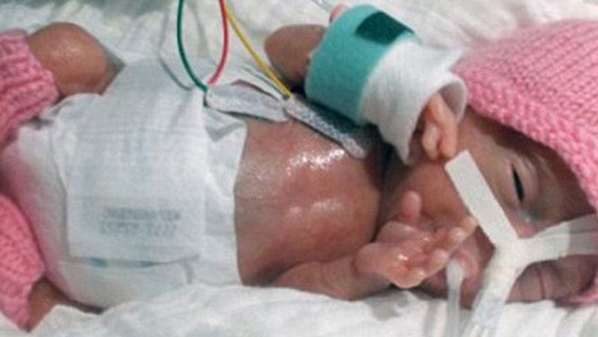 Najmniejsze dziecko na świecie