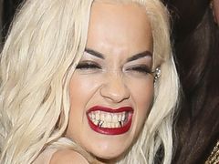 Rita Ora ze złotymi zębami