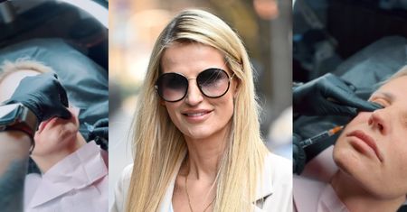 OSTRZEGAMY: Dominika Tajner relacjonuje zabieg z użyciem IGŁY. "W klinice czuję się jak w domu"