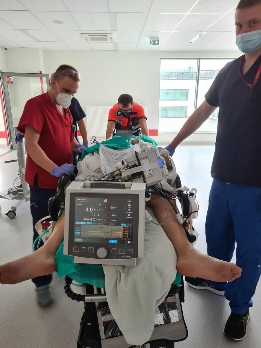 ECMO