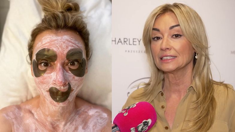 Martyna Wojciechowska stosuje zabiegi medycyny estetycznej?