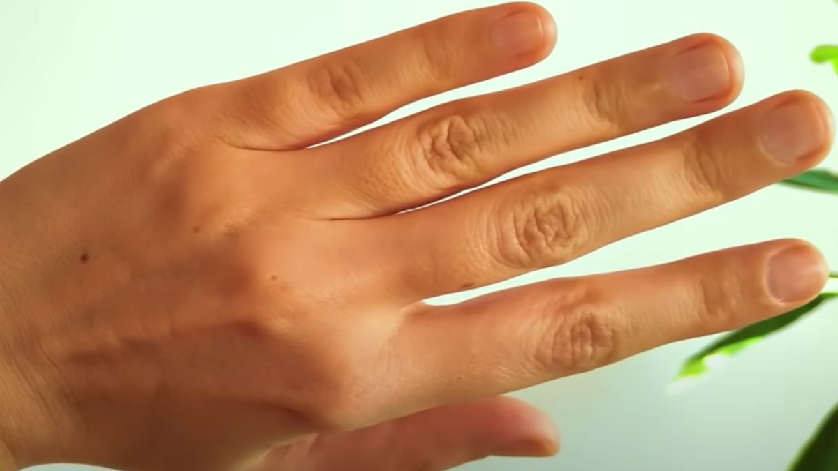 Niewiele osób populacji potrafi ruszać małym lub środkowym palcem bez poruszenia palca serdecznego