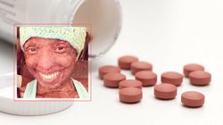 Uszkodzony wzrok i utrata 90 proc. skóry. A wszystko przez jeden lek!