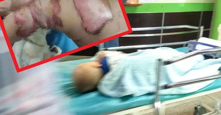 Niebezpieczny koc elektryczny. Maluch doznał oparzeń drugiego stopnia