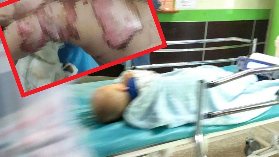 Niebezpieczny koc elektryczny. Maluch doznał oparzeń drugiego stopnia