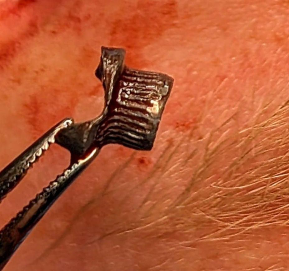 Śrut wyjęty z oczodołu