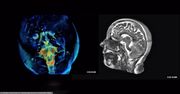 Mrożące odkrycie badaczy. Wykryli cząstki w ludzkim mózgu