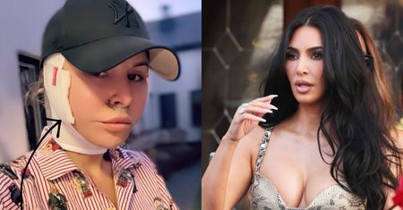Blanka Lipińska publikuje zdjęcie wykonane dobę po liftingu twarzy i ostrzega przed opaskami ze sklepu Kim: "Nie róbcie sobie KRZYWDY!"