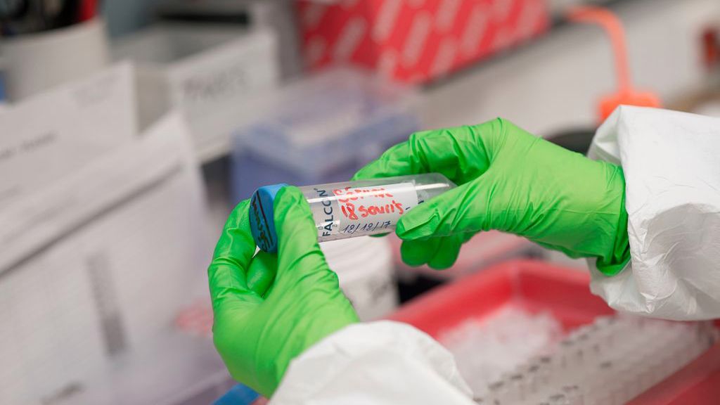 Bdania pokazują, że wątroba jest kolejnym narządem, który jest narażony na uszkodzenie w przypadku zachorowania na Covid-19