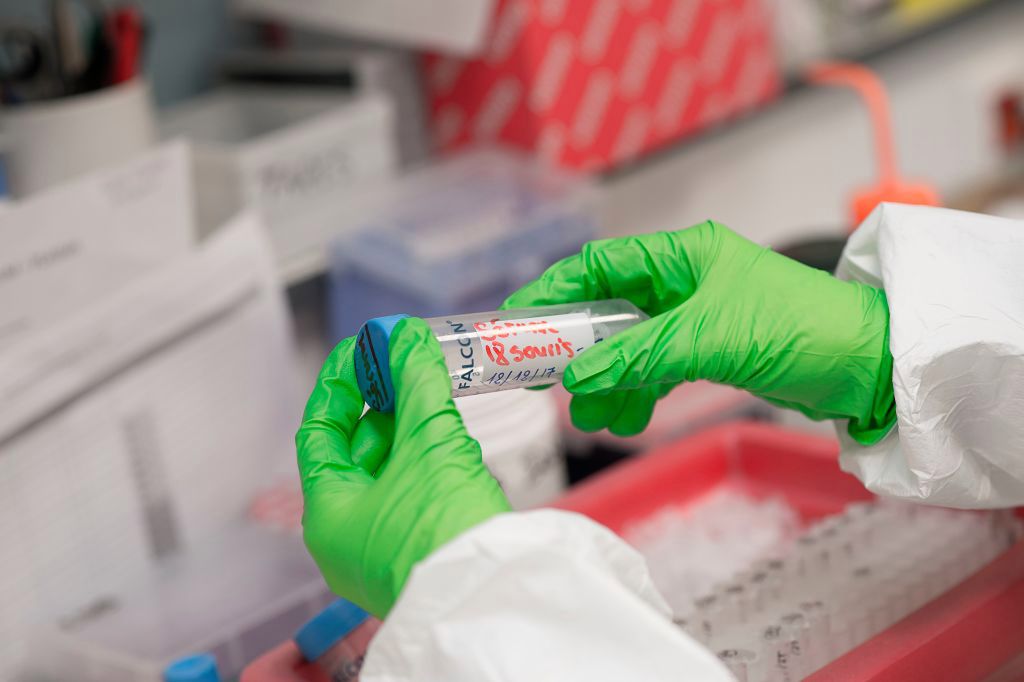 Koronawirus może uszkadzać wątrobę. Częściej zdarza się to u mężczyzn