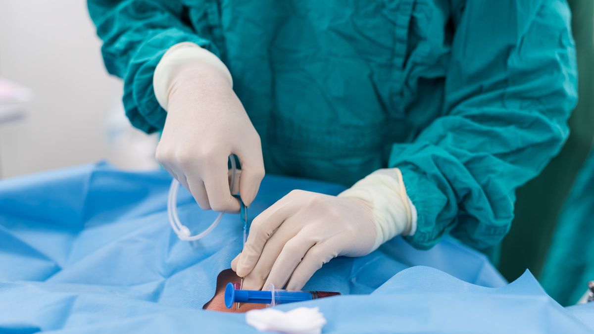 Cewnikowanie serca to badanie wykonywane w znieczuleniu miejscowym lub ogólnym.