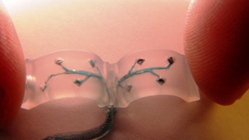 Lecznicze działanie prądu, wybawieniem dla sparaliżowanych osób 1