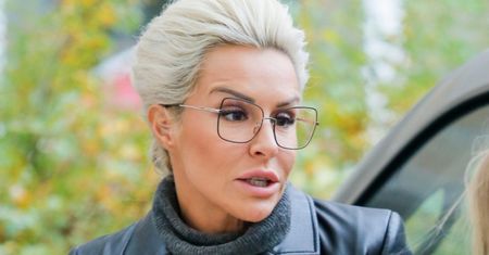 Blanka Lipińska pokazuje SKUTKI UBOCZNE wycięcia torebek tłuszczowych z policzków (FOTO)