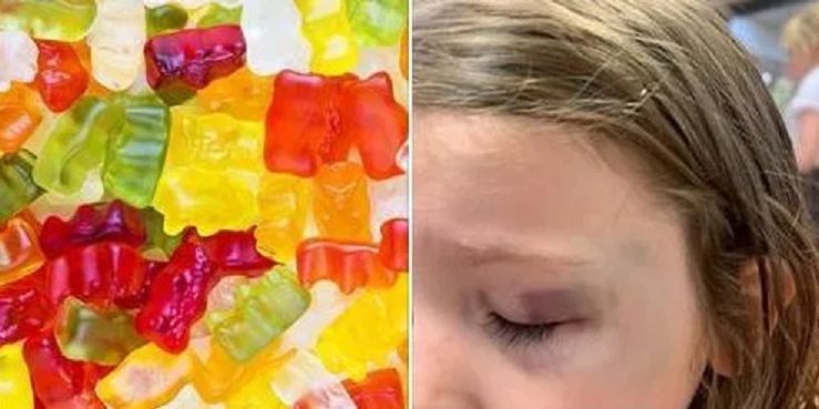 Żelki pomogą zdiagnozować, czy dziecko ma złamaną kość twarzoczaszki