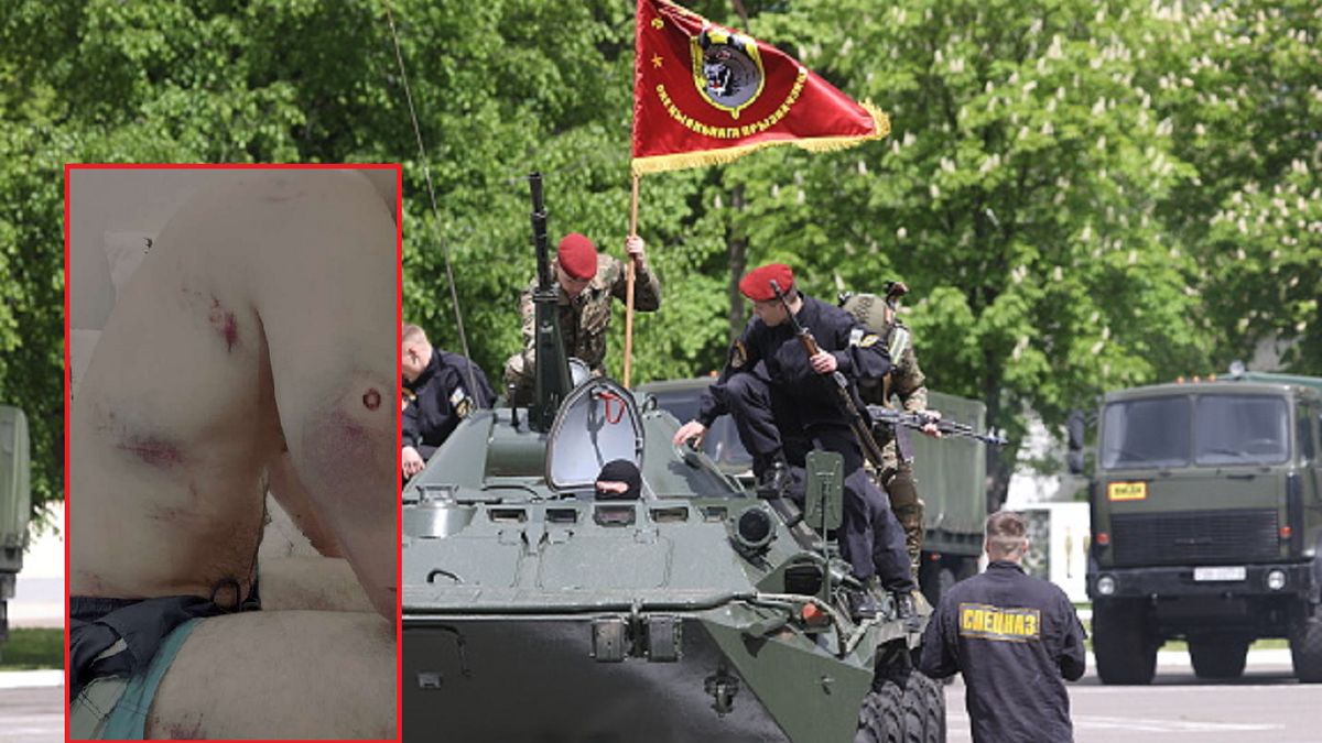 Białorusini zostali pobici.