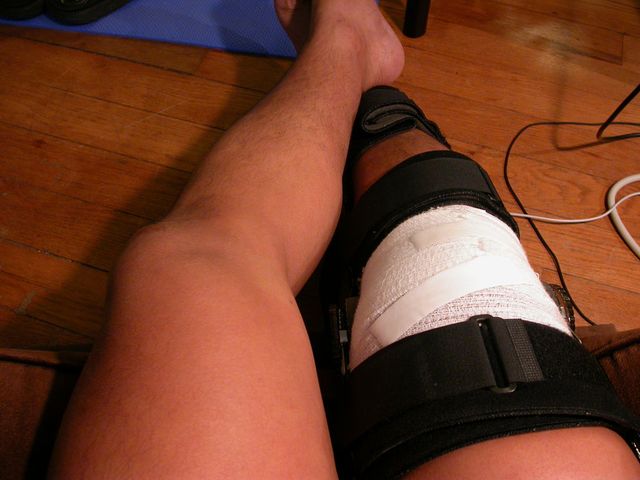 W przypadku niektórych urazów stawu kolanowego konieczne jest unieruchomienie nogi