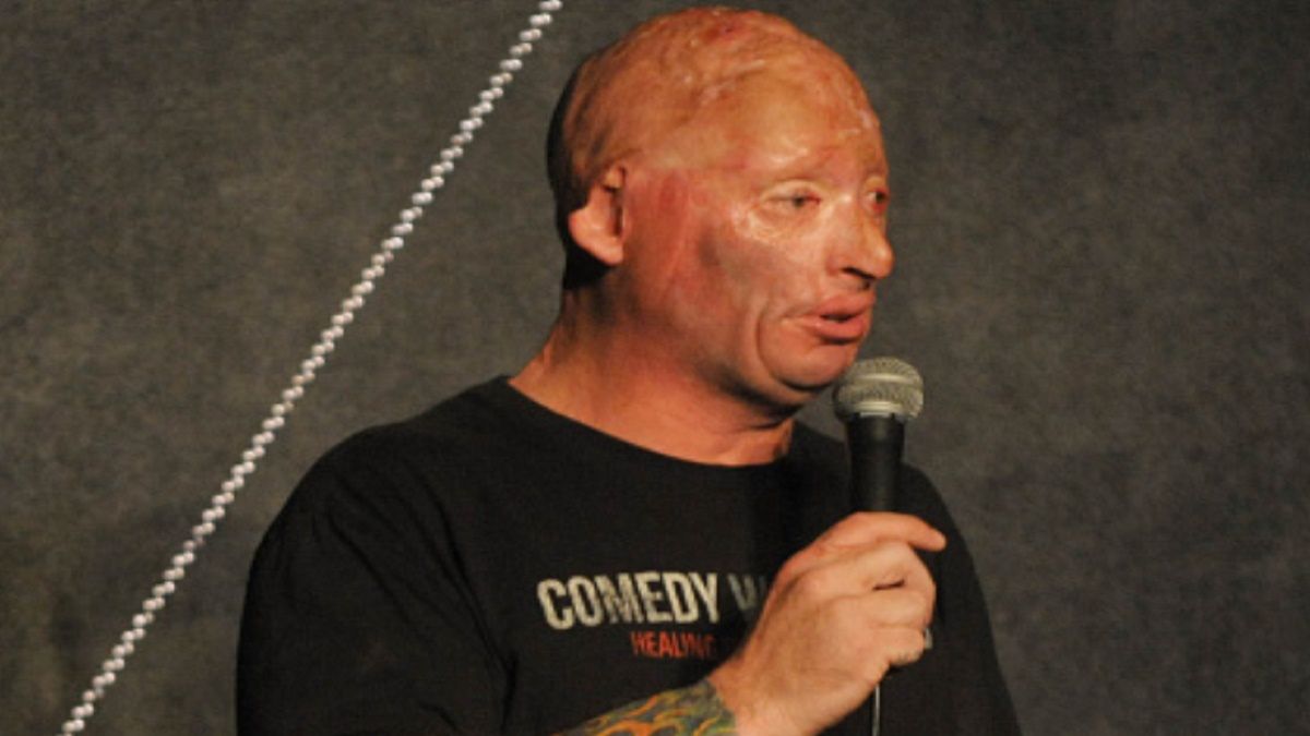 Bobby Henline jest znanym w całych Stanach Zjednoczonych weteranem z Afganistanu 