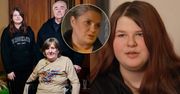 Bohaterkę "Naszego nowego domu" wyśmiewano przez chorobę. "Mam to od urodzenia"