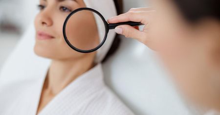 Wybroczyny na twarzy – wygląd, przyczyny, rozpoznanie i leczenie