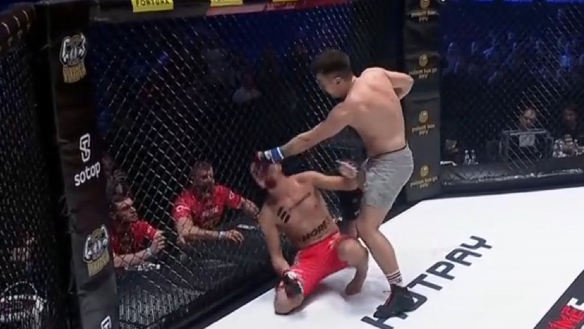 Bagieta przegrywa z Kamerzystą